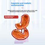 Human Digestive System Model Gastric Coronal Section Anorectal Anatomy Medical Teaching Aid For Gastroenterology
