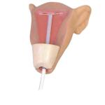 Advanced Intrauterine Contraceptive Training Model