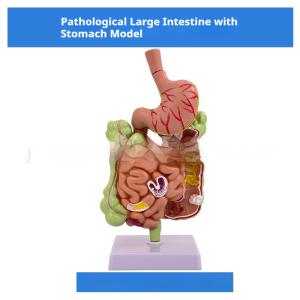 Human Digestive System Model Gastric Coronal Section Anorectal Anatomy Medical Teaching Aid For Gastroenterology