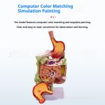 Human Digestive System Model Gastric Coronal Section Anorectal Anatomy Medical Teaching Aid For Gastroenterology
