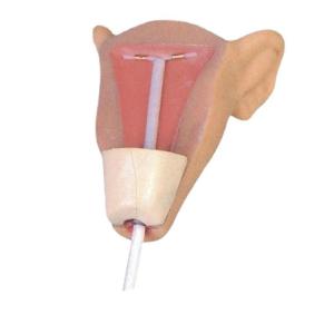 Advanced Intrauterine Contraceptive Training Model