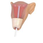 Advanced Intrauterine Contraceptive Training Model