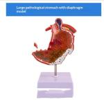 Human Digestive System Model Gastric Coronal Section Anorectal Anatomy Medical Teaching Aid For Gastroenterology